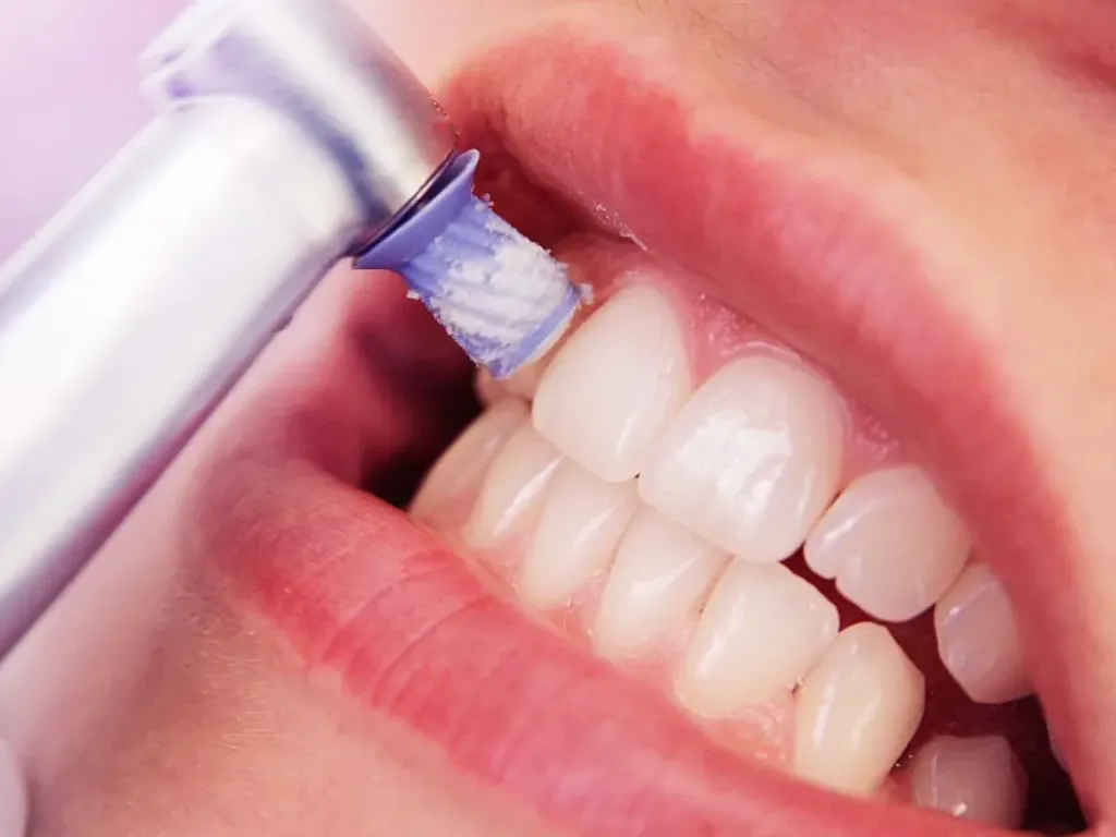 Limpieza dental
