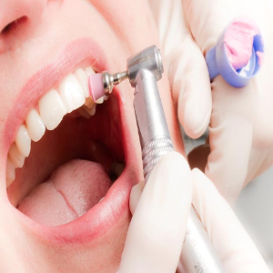 Limpieza Dental